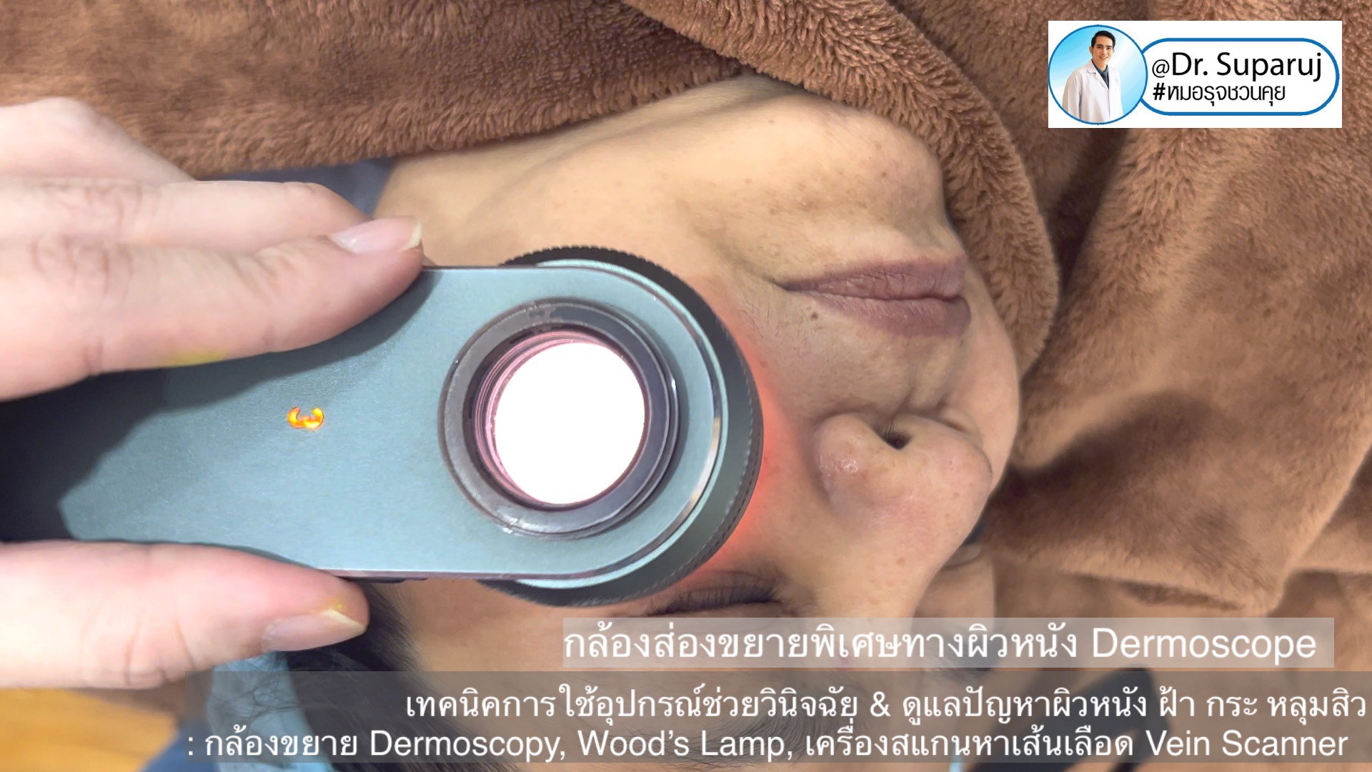 เทคนิคการใช้อุปกรณ์ช่วยวินิจฉัย & ดูแลปัญหาผิวหนัง ฝ้า กระ หลุมสิว: กล้องขยาย Dermoscopy, แว่นขยายพร้อมแสงในช่วงUV: Wood’s Lamp, เครื่องสแกนหาเส้นเลือด Vein Scanner เทคนิคการใช้อุปกรณ์ช่วยวินิจฉัย & ดูแลปัญหาผิวหนัง ฝ้า กระ หลุมสิว: กล้องขยาย Dermoscopy, แว่นขยายพร้อมแสงในช่วงUV: Wood’s Lamp, เครื่องสแกนหาเส้นเลือด Vein Scanner