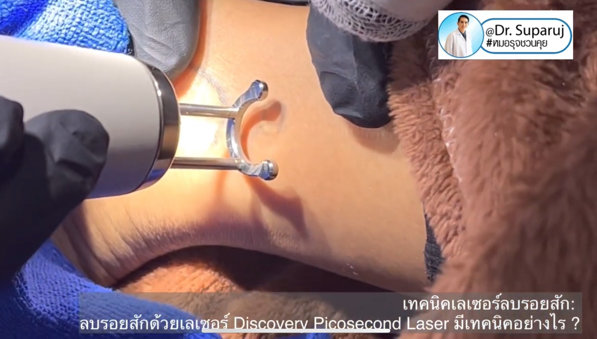 ทำไมต้องลบรอยสักด้วย พิโค่เลเซอร์ Picosecond Laser ทำไมต้องลบรอยสักด้วย พิโค่เลเซอร์ Picosecond Laser