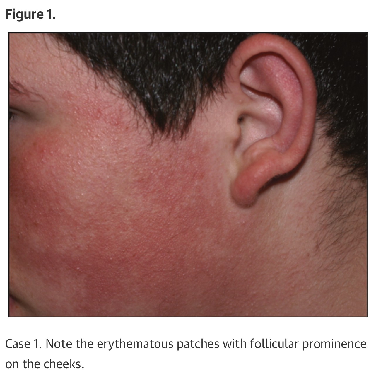 ขนคุดที่มีสีแดง KP Rubra มีลักษณะอย่างไร & ดูแลได้อย่างไร? ขนคุดที่มีสีแดง KP Rubra มีลักษณะอย่างไร & ดูแลได้อย่างไร?