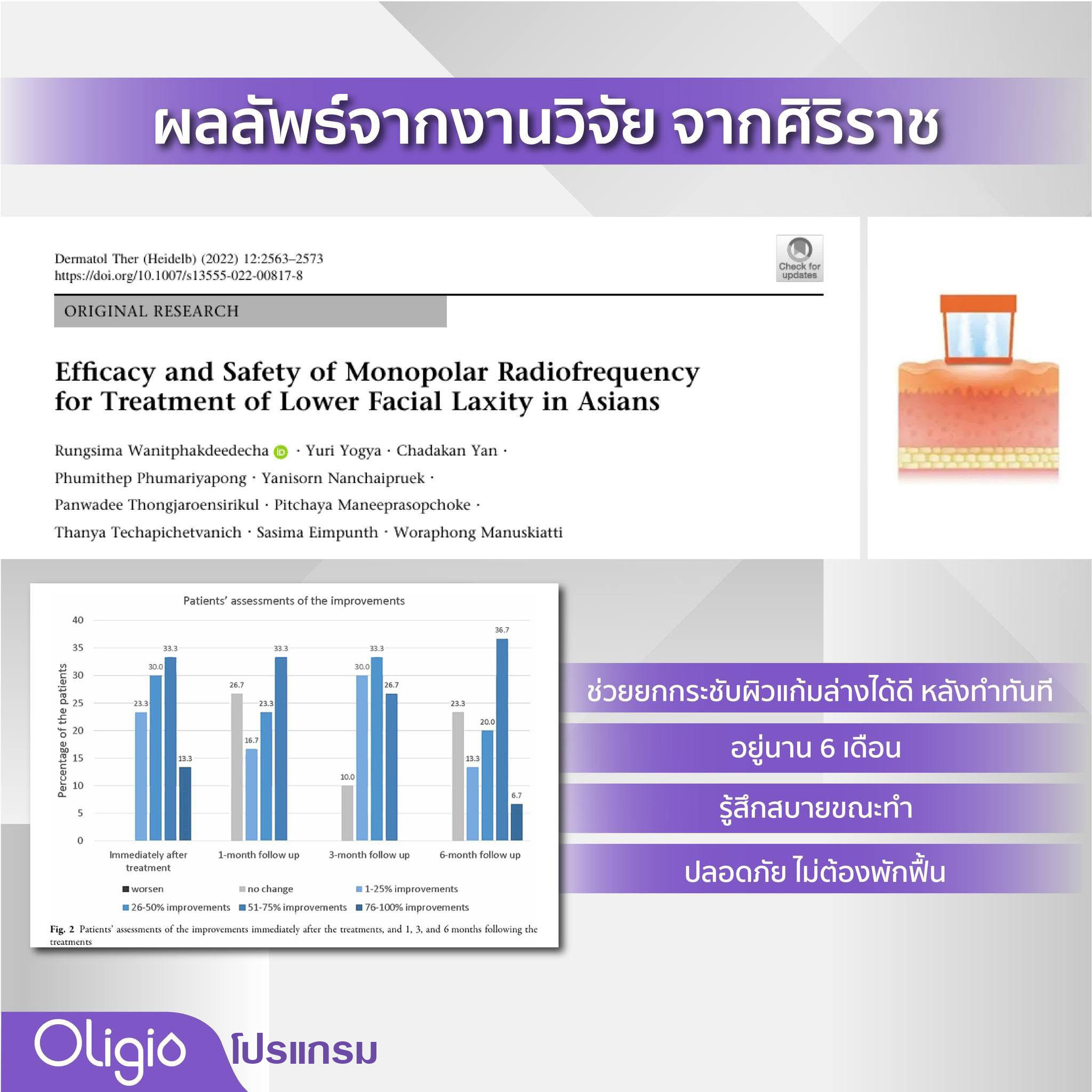 คำถามยอดฮิต นวัตกรรมกระชับผิวโปรแกรม Oligio