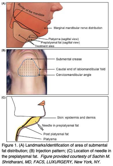 สาเหตุ & เทคนิคลดเหนียง ไขมันใต้คาง คาง 2 ชั้น Double Chin & Submental Fullness Treatment 