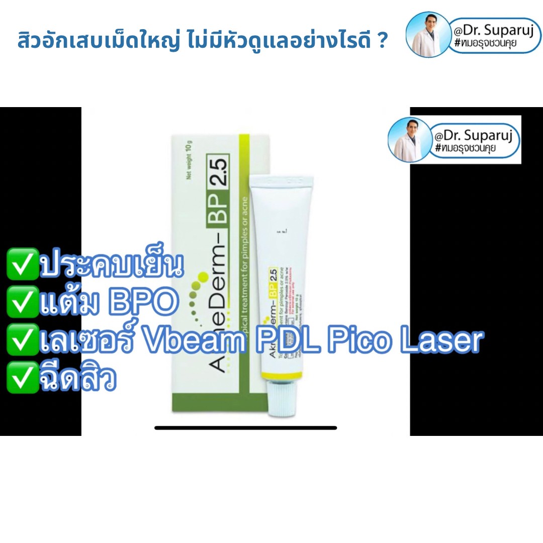 มีสิวอักเสบเม็ดใหญ่ ไม่มีหัว ขึ้น ดูแลอย่างไรดี ? มีสิวอักเสบเม็ดใหญ่ ไม่มีหัว ขึ้น ดูแลอย่างไรดี ?