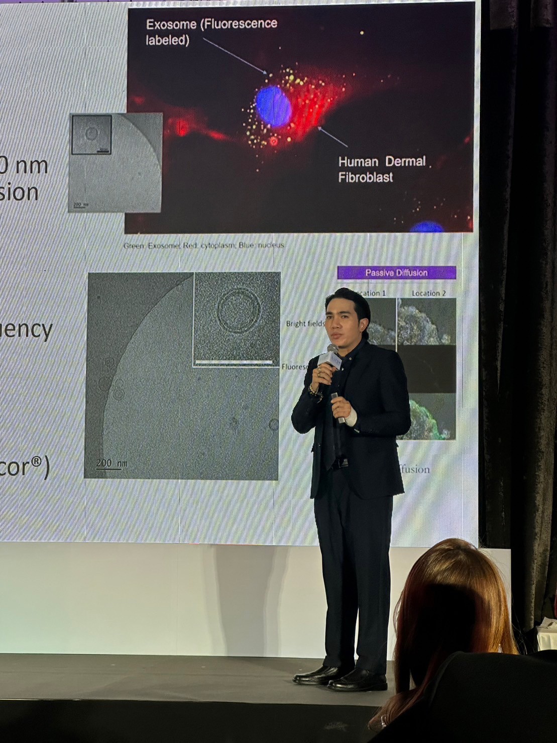 ผศ.นพ. ศุภะรุจ เลื่องอรุณ (หมอรุจ) ได้รับเชิญเป็นวิทยากร แชร์เทคนิคๆการดูแลหลุมสิว แผลเป็น ผมร่วงผมบางด้วยการใช้ Exosomes ในงานสัมมนา Exosome for Applications Medical Aesthetics ,New Paradigm in Regenerative Aesthetics : Science, Results & Protocol &q ผศ.นพ. ศุภะรุจ เลื่องอรุณ (หมอรุจ) ได้รับเชิญเป็นวิทยากร แชร์เทคนิคๆการดูแลหลุมสิว แผลเป็น ผมร่วงผมบางด้วยการใช้ Exosomes ในงานสัมมนา Exosome for Applications Medical Aesthetics ,New Paradigm in Regenerative Aesthetics : Science, Results & Protocol &q