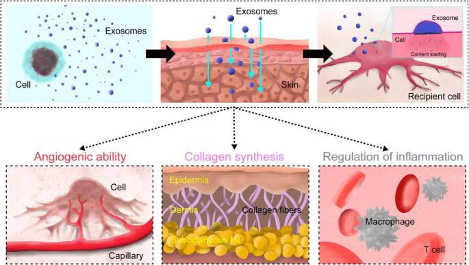 แนะนำเทคนิคดูแลปัญหาผมร่วงผมบาง: Exosome เอ็กโซโซม ช่วยดูแลผมร่วงผมบางได้อย่างไร Exosome Therapy for Hair Loss แนะนำเทคนิคดูแลปัญหาผมร่วงผมบาง: Exosome เอ็กโซโซม ช่วยดูแลผมร่วงผมบางได้อย่างไร Exosome Therapy for Hair Loss