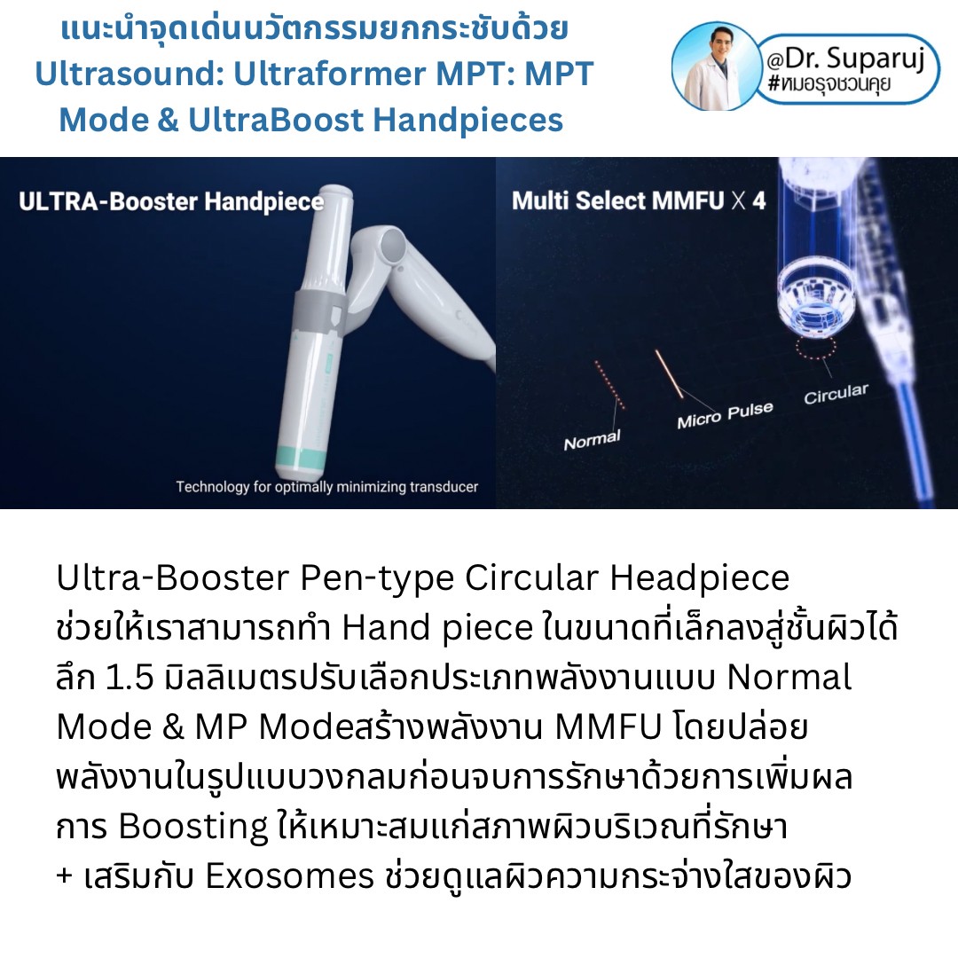 แนะนำนวัตกรรม พลังงานเครื่องเสียง Macro & Micro Focused Ultrasound ยกกระชับผิว Ultraformer MPT: จุดเด่น + ทดสอบลักษณะพลังงาน + การประเมินลักษณะผิว ให้เห็นกันชัดๆเลยครับ แนะนำนวัตกรรม พลังงานเครื่องเสียง Macro & Micro Focused Ultrasound ยกกระชับผิว Ultraformer MPT: จุดเด่น + ทดสอบลักษณะพลังงาน + การประเมินลักษณะผิว ให้เห็นกันชัดๆเลยครับ