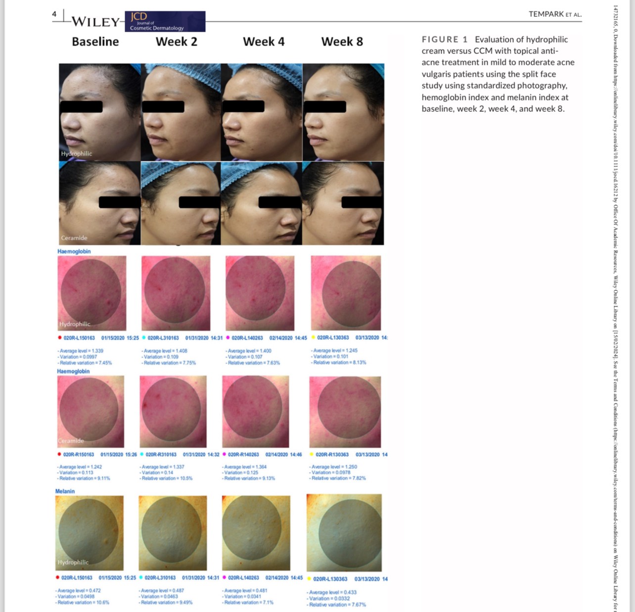 งานวิจัยการใช้มอยเจอไรเซอร์ที่มีเซราไมด์ร่วมกับการใช้ยารักษาสิว โดย ผศ. นพ. ศุภะรุจ เลื่องอรุณ (หมอรุจ) และ รศ. นพ. เทอดพงศ์ เต็มภาค ครับ งานวิจัยการใช้มอยเจอไรเซอร์ที่มีเซราไมด์ร่วมกับการใช้ยารักษาสิว โดย ผศ. นพ. ศุภะรุจ เลื่องอรุณ (หมอรุจ) และ รศ. นพ. เทอดพงศ์ เต็มภาค ครับ