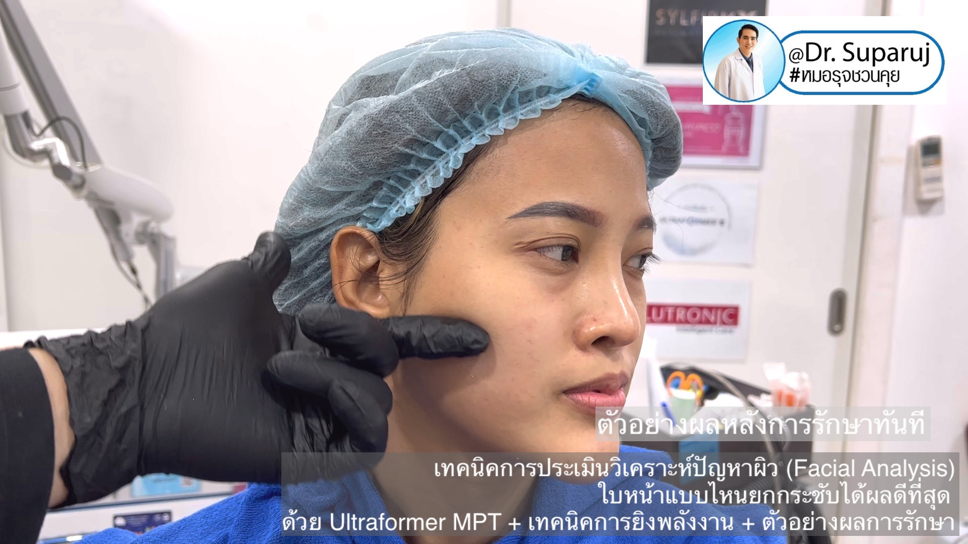 เทคนิคการประเมินวิเคราะห์ปัญหาผิว (Facial Analysis) ใบหน้าแบบไหนยกกระชับได้ผลดีที่สุด ด้วย Ultraformer MPT + เทคนิคการยิงพลังงาน + ตัวอย่างผลการรักษา เทคนิคการประเมินวิเคราะห์ปัญหาผิว (Facial Analysis) ใบหน้าแบบไหนยกกระชับได้ผลดีที่สุด ด้วย Ultraformer MPT + เทคนิคการยิงพลังงาน + ตัวอย่างผลการรักษา