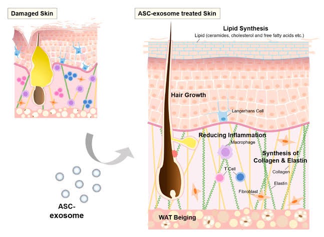 แนะนำเทคนิคดูแลปัญหาผมร่วงผมบาง: Exosome เอ็กโซโซม ช่วยดูแลผมร่วงผมบางได้อย่างไร Exosome Therapy for Hair Loss แนะนำเทคนิคดูแลปัญหาผมร่วงผมบาง: Exosome เอ็กโซโซม ช่วยดูแลผมร่วงผมบางได้อย่างไร Exosome Therapy for Hair Loss