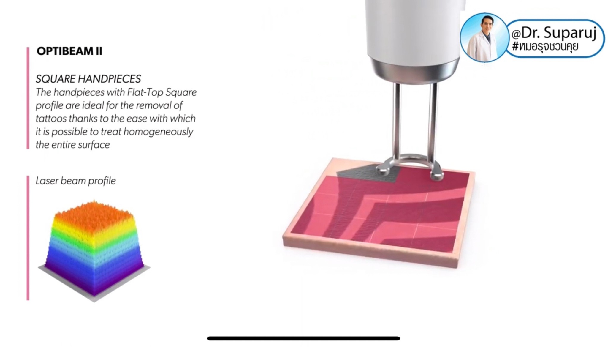 แนะนำเทคนิคดูแลริมฝีปากคล้ำ Lip Hyperpigmentation ริ้วรอย ริ้วรอยรอบริมฝีปาก: สาเหตุ การดูแล & เทคนิคเลเซอร์ MultiMode Discovery Picosecond Laser Lip Rejuvenation แนะนำเทคนิคดูแลริมฝีปากคล้ำ Lip Hyperpigmentation ริ้วรอย ริ้วรอยรอบริมฝีปาก: สาเหตุ การดูแล & เทคนิคเลเซอร์ MultiMode Discovery Picosecond Laser Lip Rejuvenation