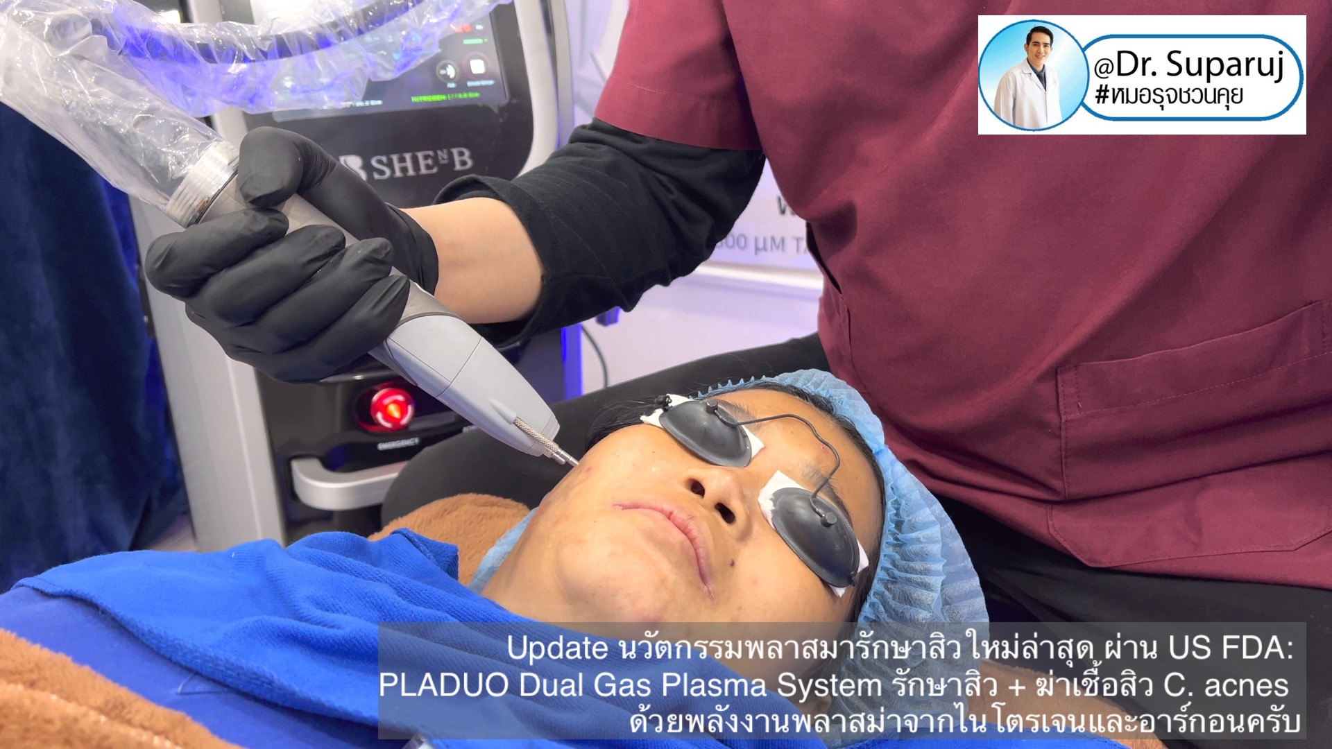Update นวัตกรรมพลาสมารักษาสิวใหม่ล่าสุด ผ่าน US FDA: PLADUO Dual Gas Plasma System ช่วยรักษาสิว + ฆ่าเชื้อสิว C. acnes + รักษาหลุมสิว รอยดำ รอยแดง Update นวัตกรรมพลาสมารักษาสิวใหม่ล่าสุด ผ่าน US FDA: PLADUO Dual Gas Plasma System ช่วยรักษาสิว + ฆ่าเชื้อสิว C. acnes + รักษาหลุมสิว รอยดำ รอยแดง