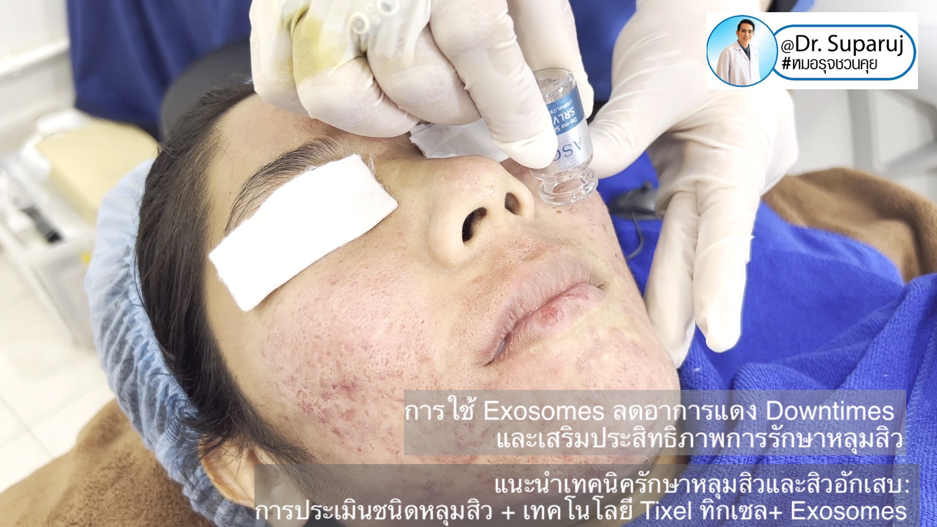 ผลลัพธ์อาจแตกต่างกันไป แล้วแต่บุคคล ผลลัพธ์อาจแตกต่างกันไป แล้วแต่บุคคล