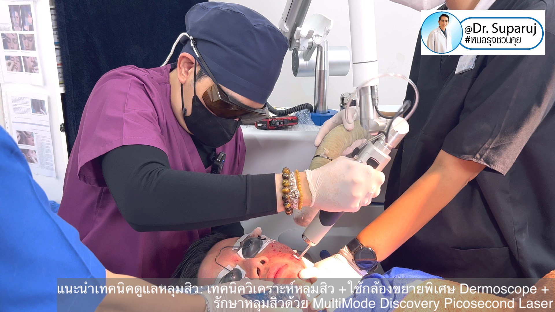 แนะนำเทคนิคดูแลหลุมสิว: เทคนิควิเคราะห์หลุมสิว +ใช้กล้องขยายพิเศษ Dermoscope + รักษาหลุมสิวด้วย MultiMode Discovery Picosecond Laser + Exosome Therapy