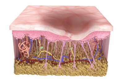 เทคนิคการประเมินพังผืด และการตัดพังผืดหลุมสิว Cannula Subcision ทำไมต้องตัดพังผืดรักษาหลุมสิว ?  (Acne Scar Fibrosis Evaluation & Cannula Subcision Treatment)