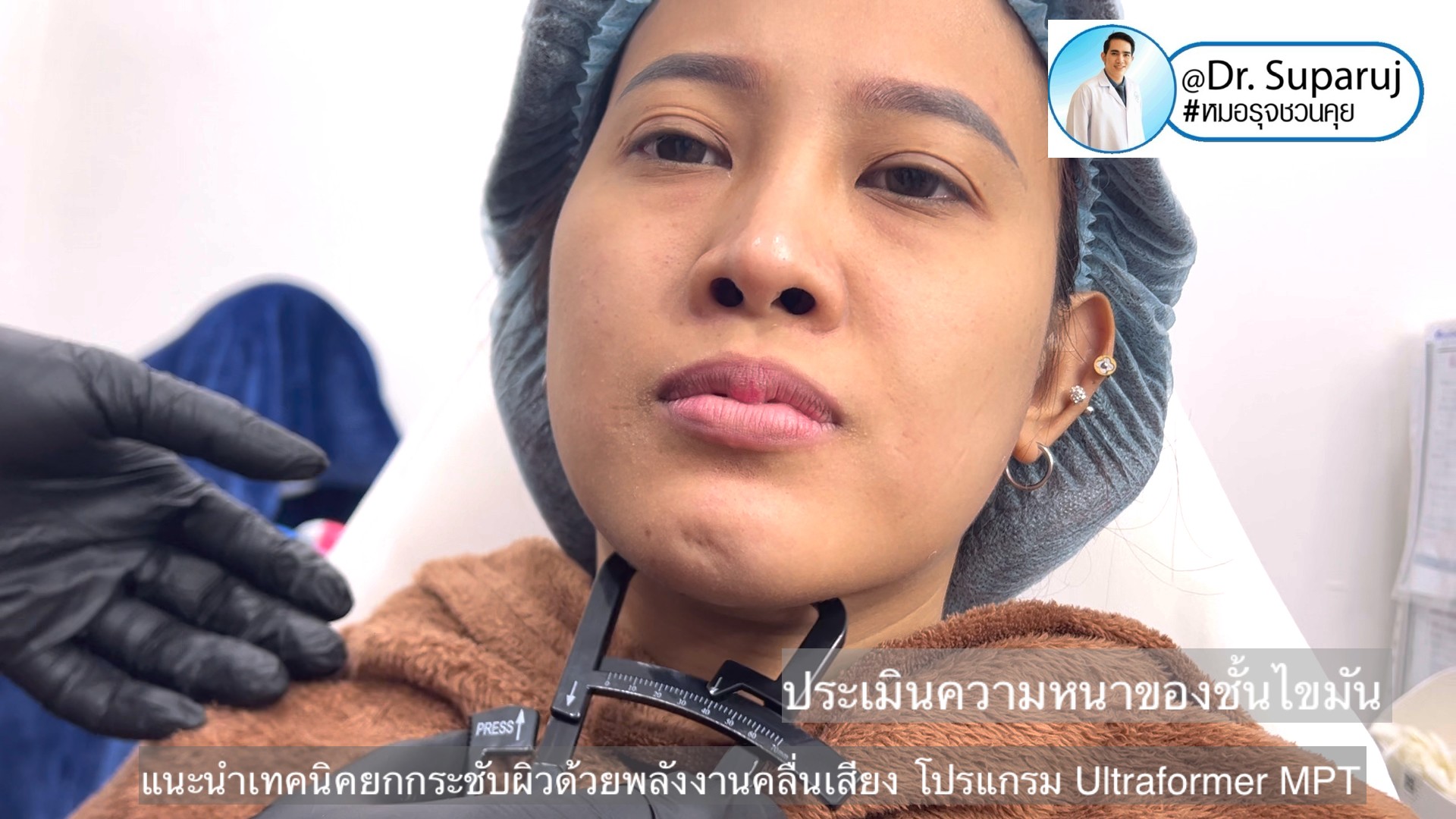 แนะนำเทคนิคยกกระชับผิว ด้วยพลังงานคลื่นเสียง MMFU Focused Ultrasound โปรแกรม Ultraformer MPT แนะนำเทคนิคยกกระชับผิว ด้วยพลังงานคลื่นเสียง MMFU Focused Ultrasound โปรแกรม Ultraformer MPT