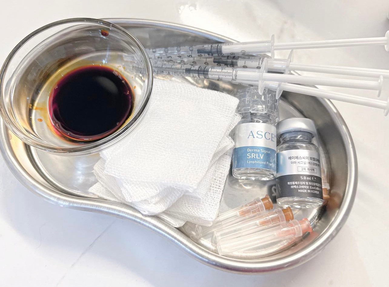 แนะนำเทคนิคดูแลปัญหาผมร่วงผมบาง: Exosome เอ็กโซโซม ช่วยดูแลผมร่วงผมบางได้อย่างไร? แนะนำเทคนิคดูแลปัญหาผมร่วงผมบาง: Exosome เอ็กโซโซม ช่วยดูแลผมร่วงผมบางได้อย่างไร?