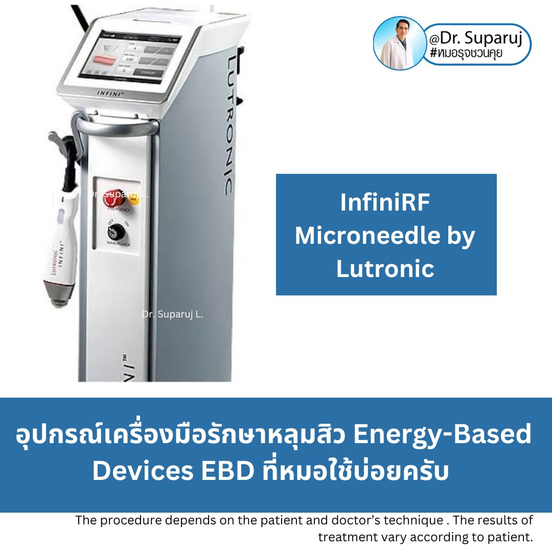 Update Energy-based Devices EBD อุปกรณ์เครื่องมือ ที่มีให้การดูแลรักษา ปัญหาผิว หลุมสิว ผมร่วงผมบาง แผลเป็น ขนคุดครับ (Update November 2023)