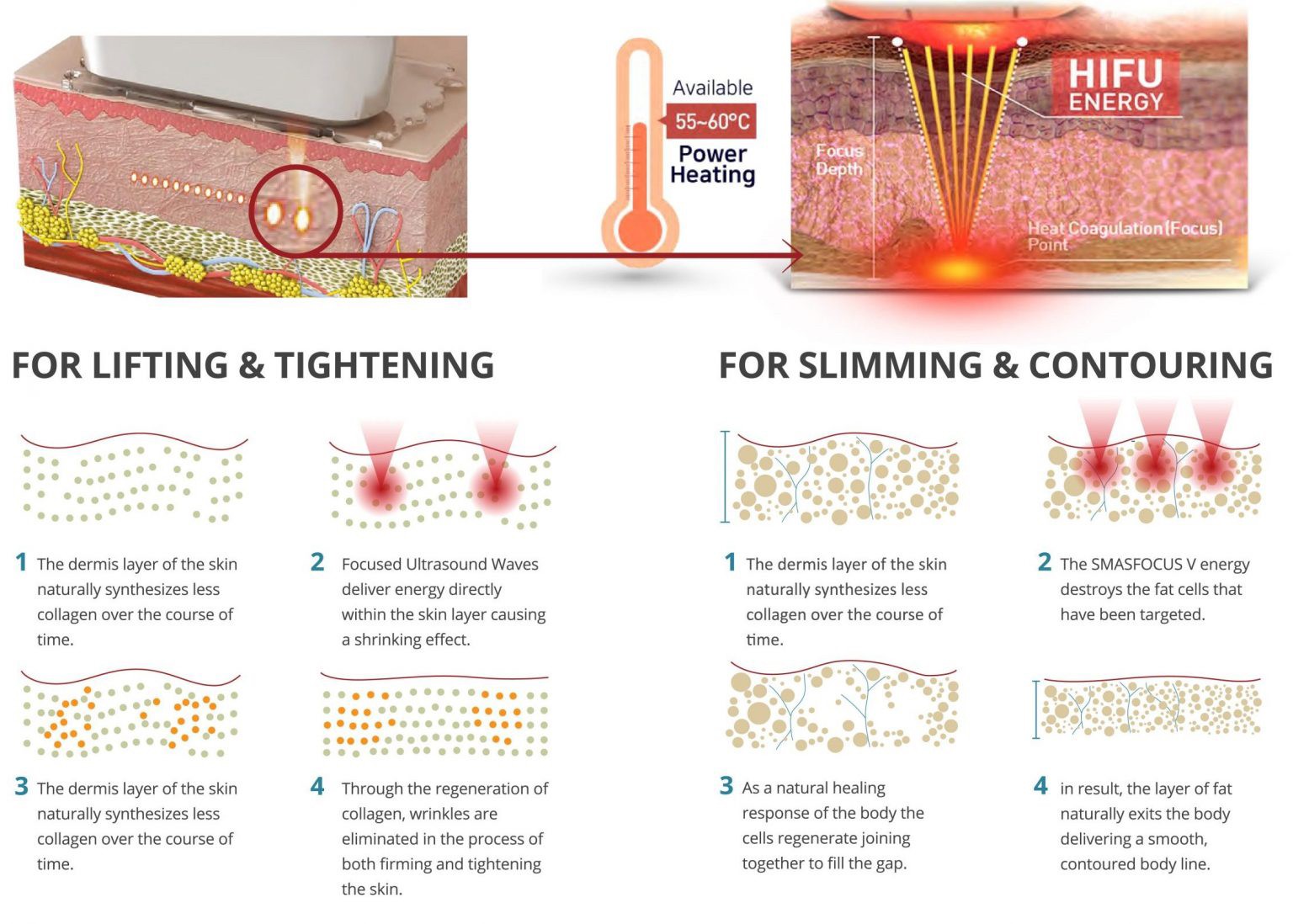 แนะนำเทคนิคยกกระชับใบหน้า: วิเคราะห์ผิว +ยกกระชับด้วย Ultraformer III ( Facial Analysis and Ultraformer III for Facial Tightening & Lifting)