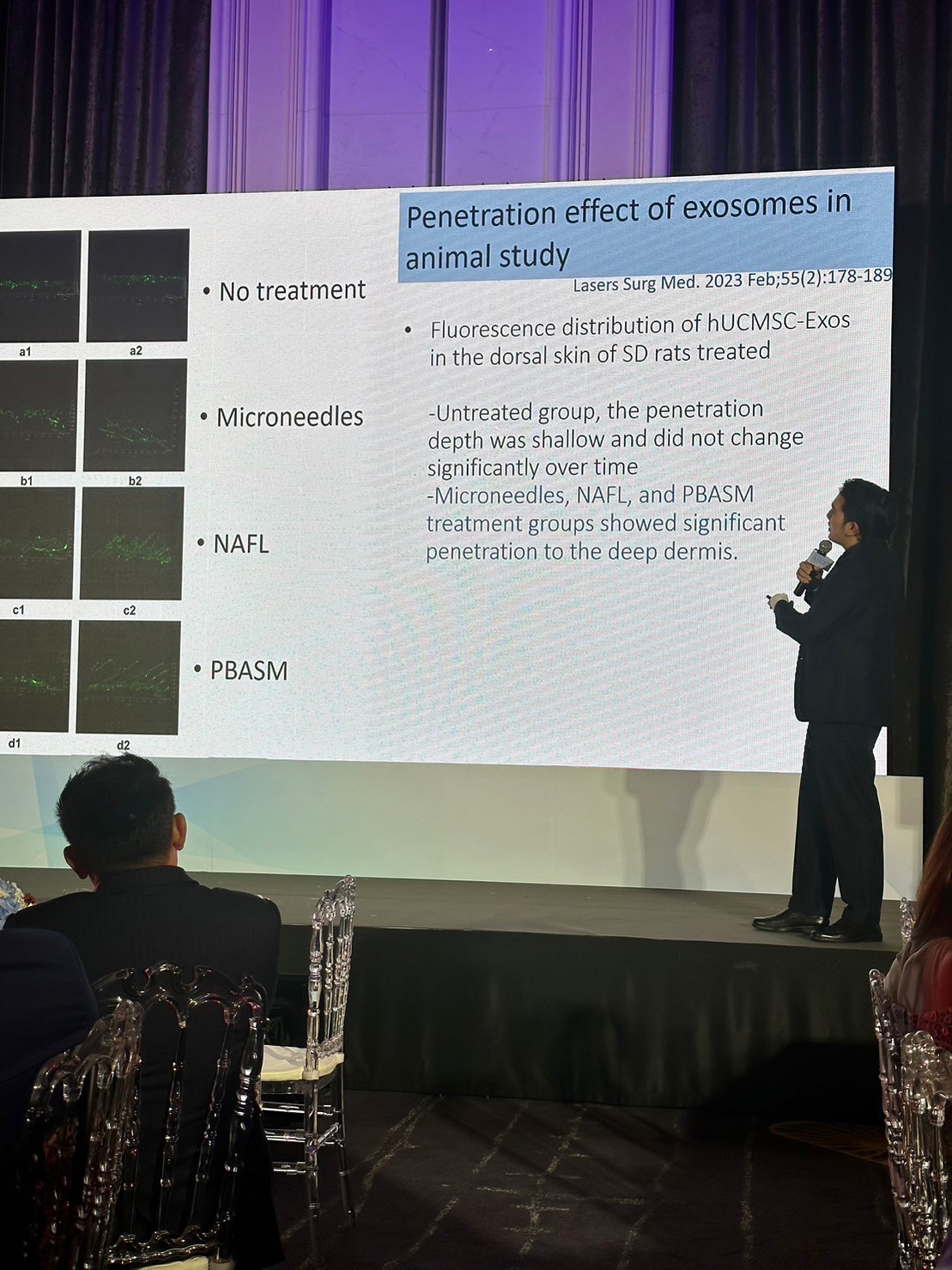 ผศ.นพ. ศุภะรุจ เลื่องอรุณ (หมอรุจ) ได้รับเชิญเป็นวิทยากร แชร์เทคนิคๆการดูแลหลุมสิว แผลเป็น ผมร่วงผมบางด้วยการใช้ Exosomes ในงานสัมมนา Exosome for Applications Medical Aesthetics ,New Paradigm in Regenerative Aesthetics : Science, Results & Protocol &q ผศ.นพ. ศุภะรุจ เลื่องอรุณ (หมอรุจ) ได้รับเชิญเป็นวิทยากร แชร์เทคนิคๆการดูแลหลุมสิว แผลเป็น ผมร่วงผมบางด้วยการใช้ Exosomes ในงานสัมมนา Exosome for Applications Medical Aesthetics ,New Paradigm in Regenerative Aesthetics : Science, Results & Protocol &q