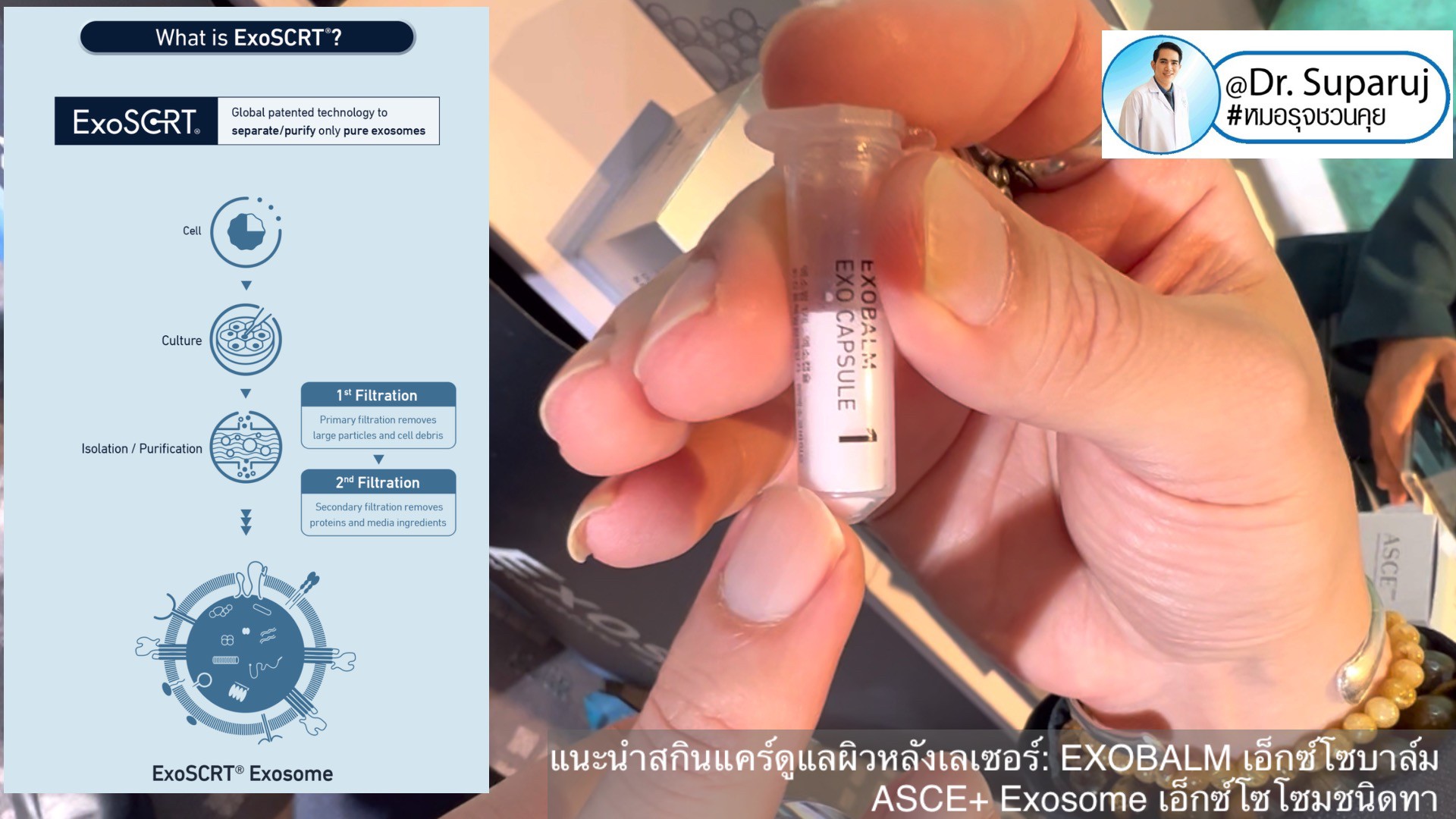 แนะนำสกินแคร์ดูแลผิวหลังเลเซอร์: EXOBALM เอ็กซ์โซบาล์ม ASCE+ Exosome เอ็กซ์โซโซมชนิดทา ดูแลผิวหลังเลเซอร์ ผิวหนังอักเสบ (+ สกินแคร์อื่นๆที่ใช้หลังเลเซอร์ ) 