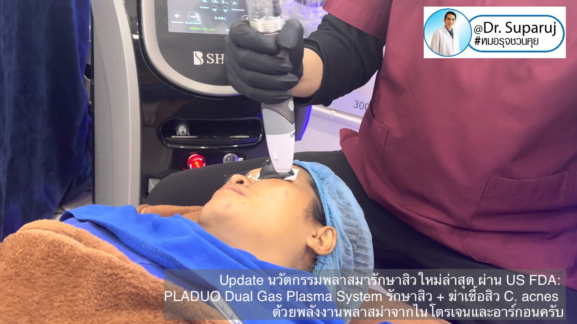 Update นวัตกรรมพลาสมารักษาสิวใหม่ล่าสุด ผ่าน US FDA: PLADUO Dual Gas Plasma System ช่วยรักษาสิว + ฆ่าเชื้อสิว C. acnes + รักษาหลุมสิว รอยดำ รอยแดง Update นวัตกรรมพลาสมารักษาสิวใหม่ล่าสุด ผ่าน US FDA: PLADUO Dual Gas Plasma System ช่วยรักษาสิว + ฆ่าเชื้อสิว C. acnes + รักษาหลุมสิว รอยดำ รอยแดง