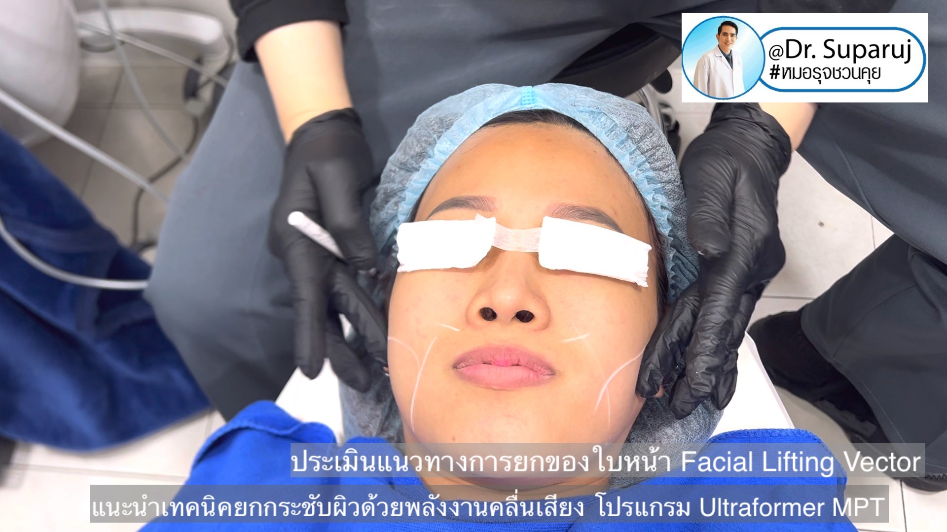 แนะนำเทคนิคยกกระชับผิว ด้วยพลังงานคลื่นเสียง MMFU Focused Ultrasound โปรแกรม Ultraformer MPT แนะนำเทคนิคยกกระชับผิว ด้วยพลังงานคลื่นเสียง MMFU Focused Ultrasound โปรแกรม Ultraformer MPT