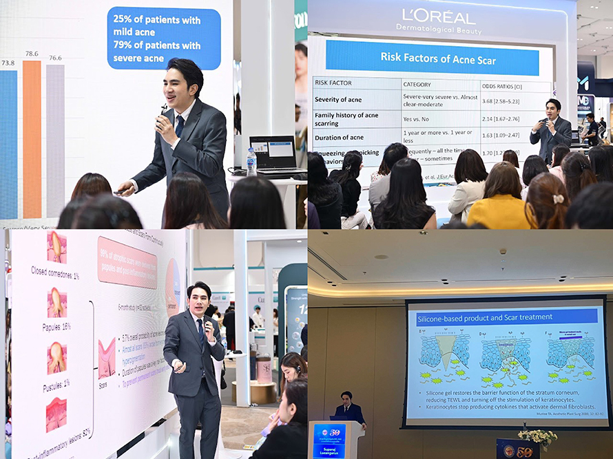 ผศ. นพ. ศุภะรุจ เลื่องอรุณ (หมอรุจ) ว 31954 ได้รับ เกียรติเป็นวิทยากร บรรยายในงานประชุมใหญ่สามัญประจำปีของสมาคมแพทย์ผิวหนังแห่งประเทศไทย(DST Annual Meeting 2025) ผศ. นพ. ศุภะรุจ เลื่องอรุณ (หมอรุจ) ว 31954 ได้รับ เกียรติเป็นวิทยากร บรรยายในงานประชุมใหญ่สามัญประจำปีของสมาคมแพทย์ผิวหนังแห่งประเทศไทย(DST Annual Meeting 2025)