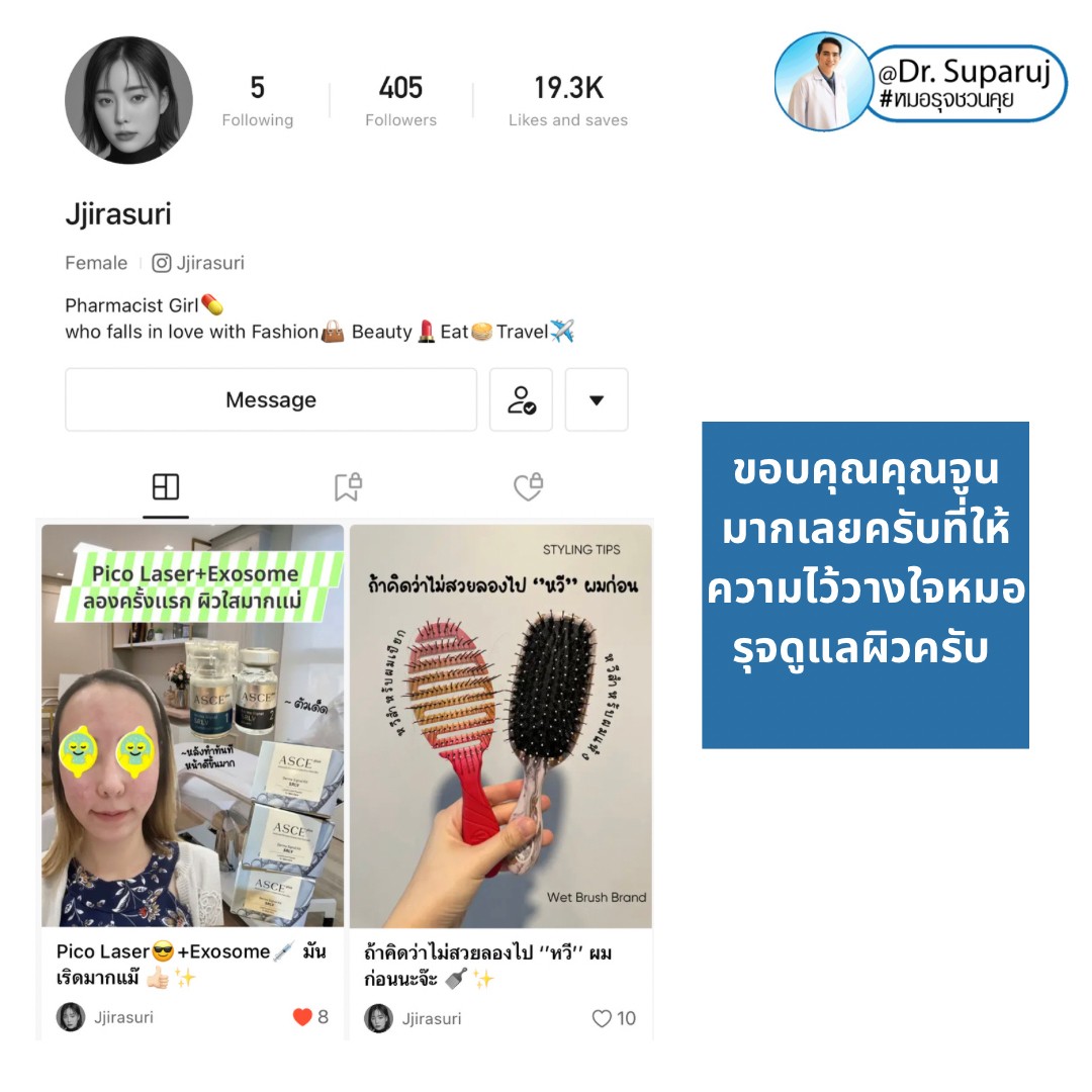 รีวิวรักษาหลุมสิวด้วย Pico Laser +Exosome มันเริดมากแม๊ รีวิวรักษาหลุมสิวด้วย Pico Laser +Exosome มันเริดมากแม๊