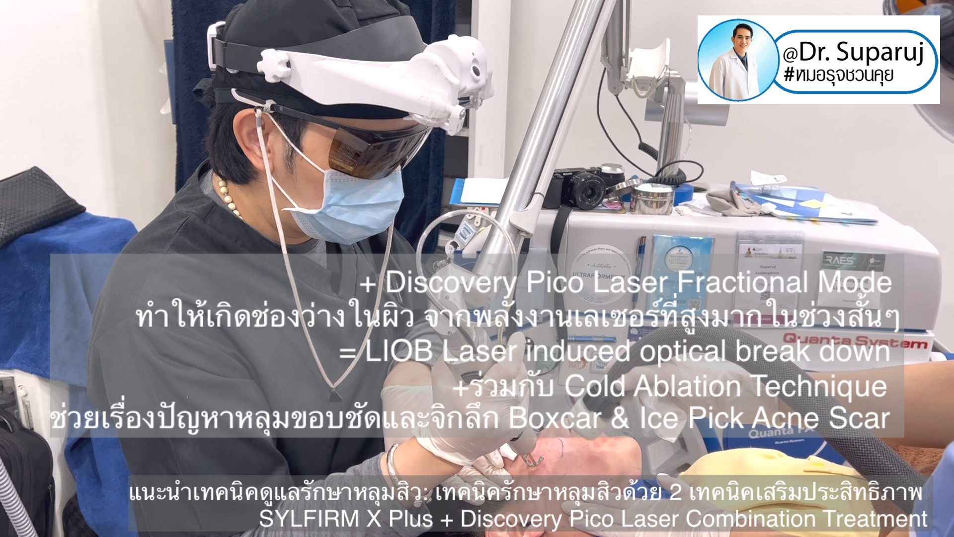 แนะนำเทคนิคดูแลรักษาหลุมสิว: เทคนิครักษาหลุมสิวด้วย 2 เทคนิคเสริมประสิทธิภาพ SYLFIRM X Plus + Discovery Pico Laser Combination Treatment แนะนำเทคนิคดูแลรักษาหลุมสิว: เทคนิครักษาหลุมสิวด้วย 2 เทคนิคเสริมประสิทธิภาพ SYLFIRM X Plus + Discovery Pico Laser Combination Treatment