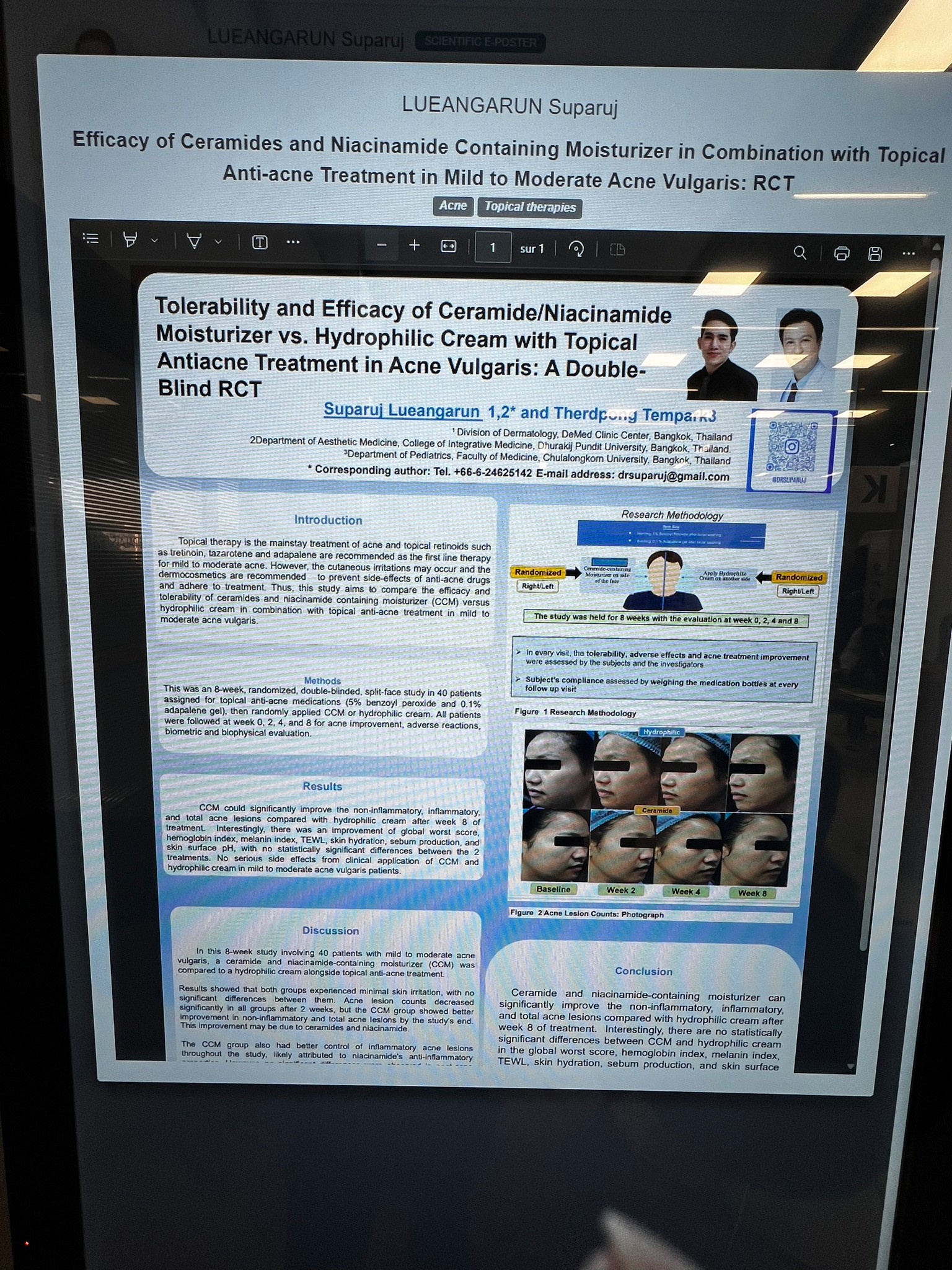 หมอรุจ ผศ. นพ. ศุภะรุจ เลื่องอรุณ ได้รับเกียรติเชิญให้เป็นวิทยากรในการประชุมทางด้านผิวหนังและศัลยกรรมตกแต่งระดับนานาชาติ ที่ใหญ่ที่สุดในโลก IMCAS World Congress 2024 ซึ่งปีนี้การประชุมจัดขึ้นที่ ศูนย์ประชุม Le Palais Des Congres (Paris) กรุงปารีส ที่ประเทศฝรั่งเศส หมอรุจ ผศ. นพ. ศุภะรุจ เลื่องอรุณ ได้รับเกียรติเชิญให้เป็นวิทยากรในการประชุมทางด้านผิวหนังและศัลยกรรมตกแต่งระดับนานาชาติ ที่ใหญ่ที่สุดในโลก IMCAS World Congress 2024 ซึ่งปีนี้การประชุมจัดขึ้นที่ ศูนย์ประชุม Le Palais Des Congres (Paris) กรุงปารีส ที่ประเทศฝรั่งเศส
