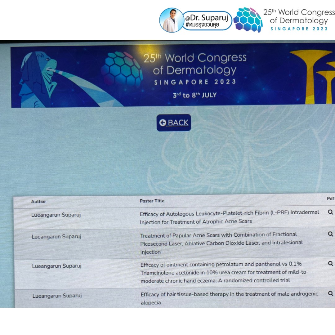 หมอรุจได้เข้าร่วมประชุม และนำเสนอผลงานวิจัยด้านการรักษาหลุมสิวแผลเป็นผมร่วงผมบาง ในงานประชุมแพทย์ผิวหนังระดับโลก World Congress of Dermatology WCD2023 ที่ประเทศสิงคโปร์ครับ หมอรุจได้เข้าร่วมประชุม และนำเสนอผลงานวิจัยด้านการรักษาหลุมสิวแผลเป็นผมร่วงผมบาง ในงานประชุมแพทย์ผิวหนังระดับโลก World Congress of Dermatology WCD2023 ที่ประเทศสิงคโปร์ครับ