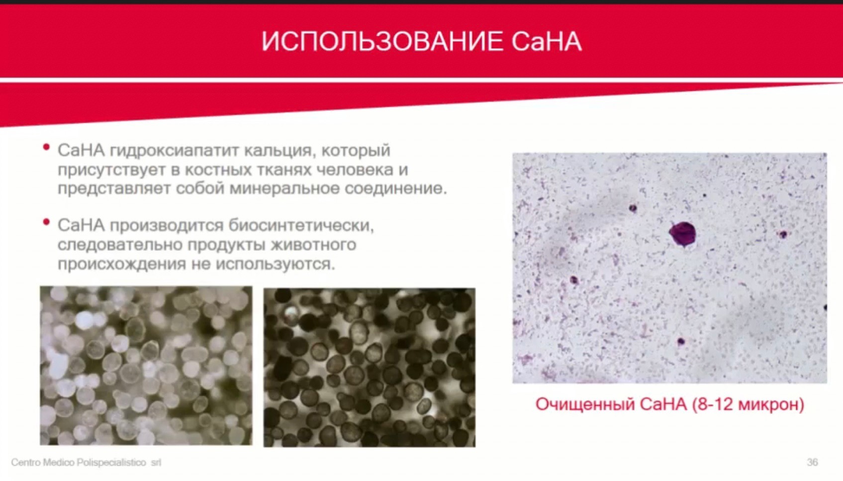 Update Skin Booster ตัวใหม่ Neauvia Hydro Deluxe: Calcium Hydroxyapatite CaHA สร้างคอลลาเจนหลุมสิว Collagen Biostimulator + Non Cross-linked Hyaluronic Acid (HA) ให้ความชุ่มชื้นผิว Skin Booster ครับ Update Skin Booster ตัวใหม่ Neauvia Hydro Deluxe: Calcium Hydroxyapatite CaHA สร้างคอลลาเจนหลุมสิว Collagen Biostimulator + Non Cross-linked Hyaluronic Acid (HA) ให้ความชุ่มชื้นผิว Skin Booster ครับ