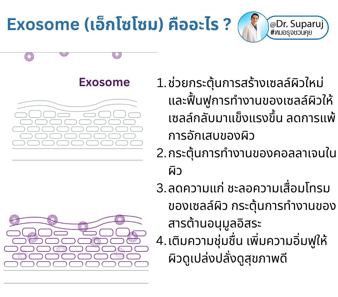 Exosomes มีบทบาทและกลไกในการดูแลฝ้า หรือไม่ & กลไกลเป็นอย่างไร ? Exosomes มีบทบาทและกลไกในการดูแลฝ้า หรือไม่ & กลไกลเป็นอย่างไร ?