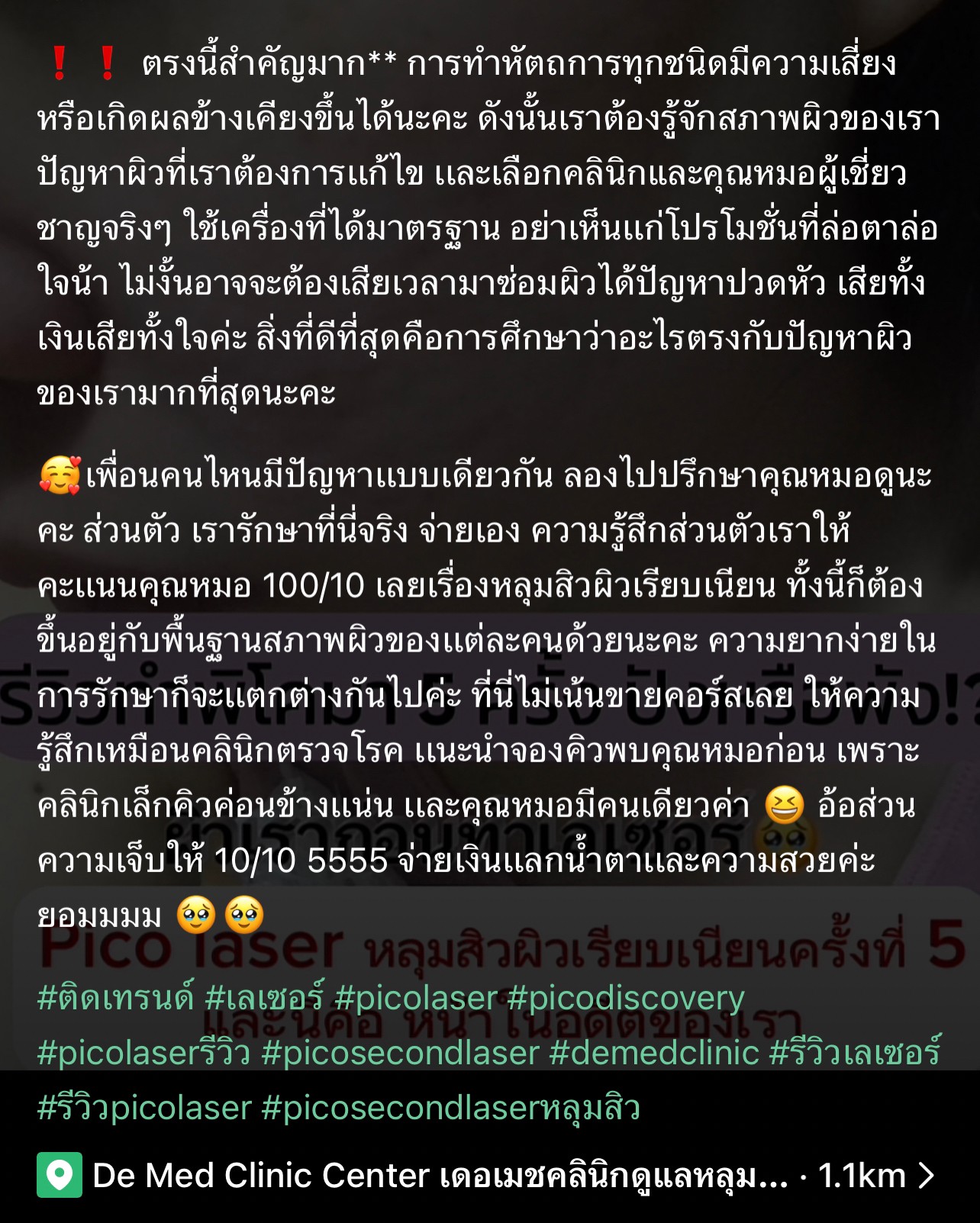 รีวิว Pico Laser รักษาหลุมสิวครั้งที่ 5 ปังหรือพังมาดู !? รีวิว Pico Laser รักษาหลุมสิวครั้งที่ 5 ปังหรือพังมาดู !?