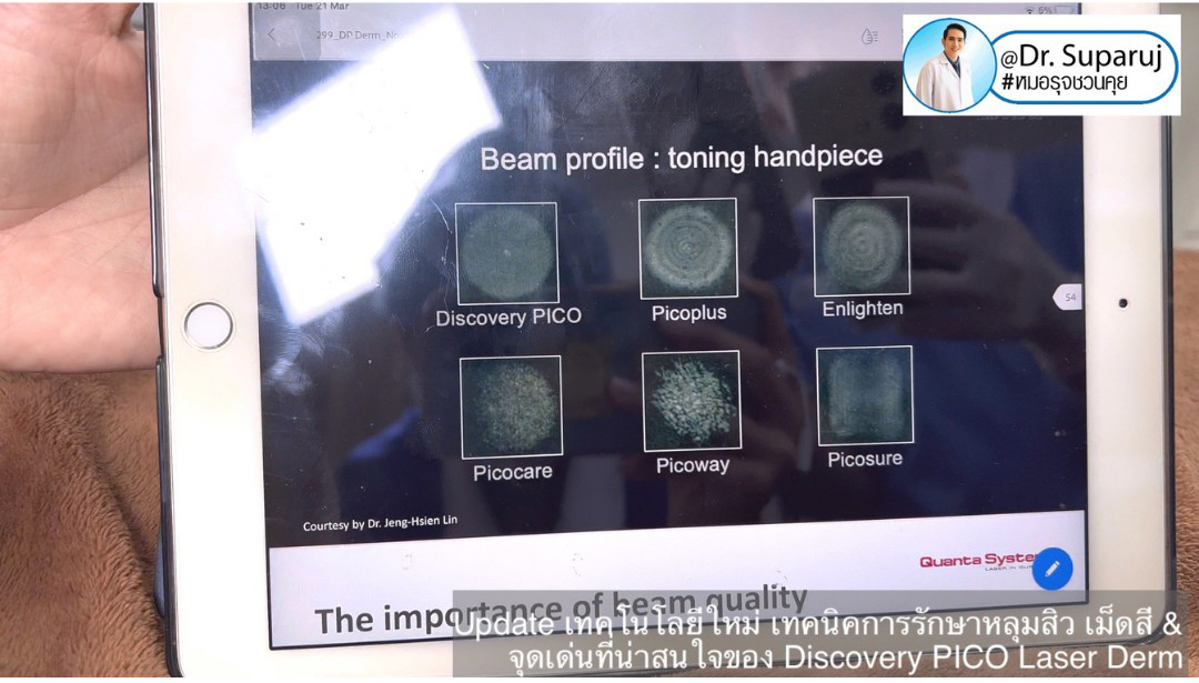 Update Discovery Picosecond Laser จุดเด่น & หลักการทำงาน ใช้ดูแลหลุมสิว แผลเป็น รอยแตกลาย ฝ้า กระจุดด่างดำ ได้อย่างไร ? 