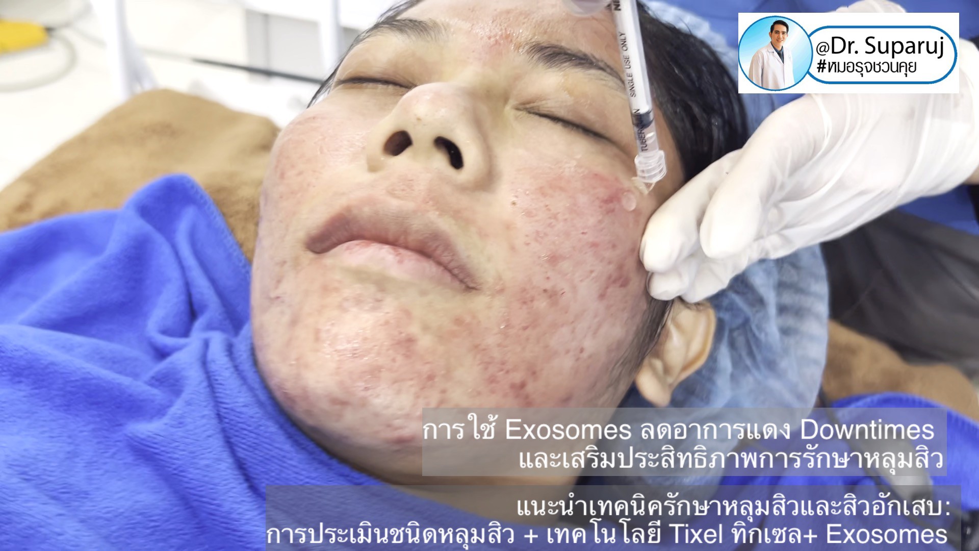 ผลลัพธ์อาจแตกต่างกันไป แล้วแต่บุคคล ผลลัพธ์อาจแตกต่างกันไป แล้วแต่บุคคล