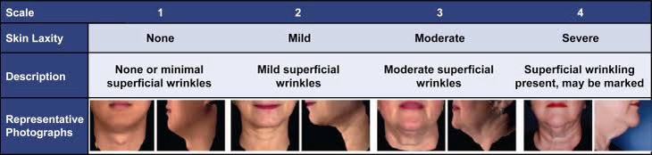 สาเหตุ & เทคนิคลดเหนียง ไขมันใต้คาง คาง 2 ชั้น Double Chin & Submental Fullness Treatment สาเหตุ & เทคนิคลดเหนียง ไขมันใต้คาง คาง 2 ชั้น Double Chin & Submental Fullness Treatment