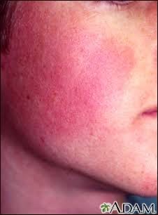 ขนคุดที่มีสีแดง KP Rubra มีลักษณะอย่างไร & ดูแลได้อย่างไร? ขนคุดที่มีสีแดง KP Rubra มีลักษณะอย่างไร & ดูแลได้อย่างไร?