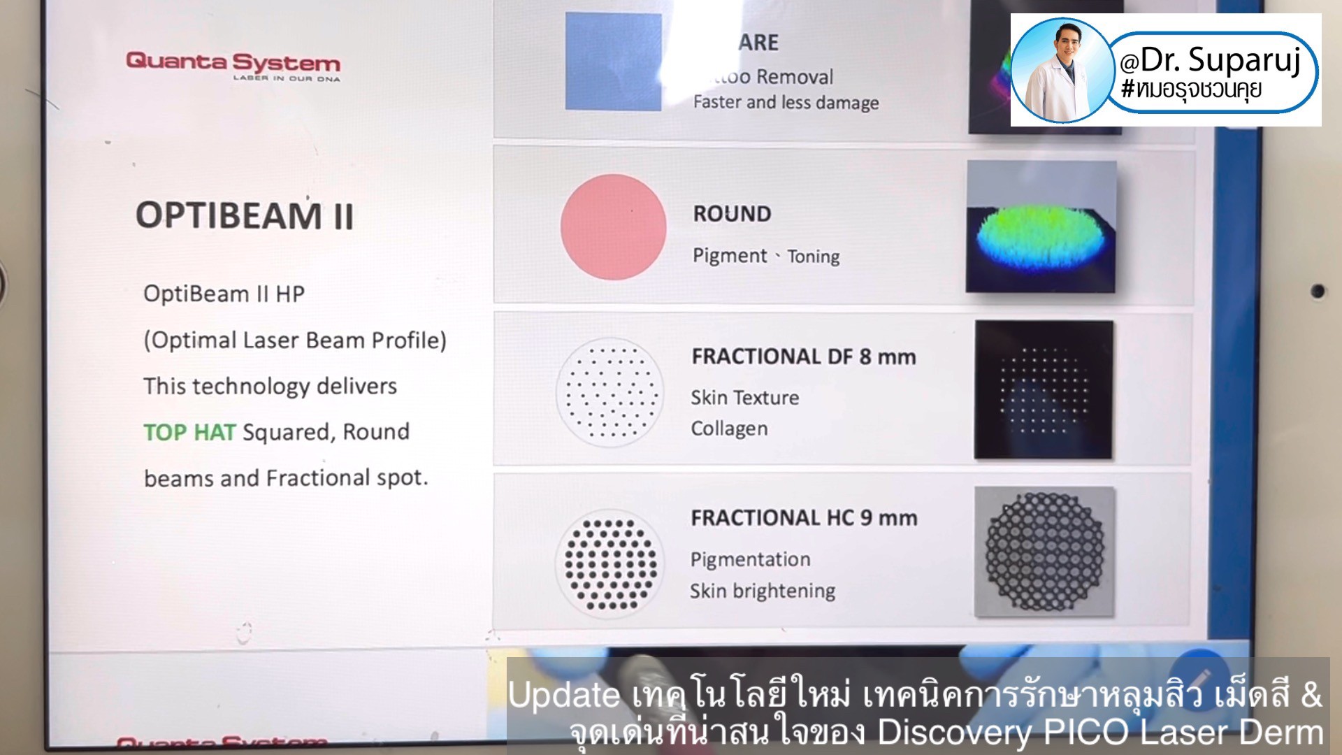 Update เทคโนโลยีใหม่ เทคนิคการรักษาหลุมสิว เม็ดสี & จุดเด่นที่น่าสนใจของ Discovery PICO Laser Derm Update เทคโนโลยีใหม่ เทคนิคการรักษาหลุมสิว เม็ดสี & จุดเด่นที่น่าสนใจของ Discovery PICO Laser Derm