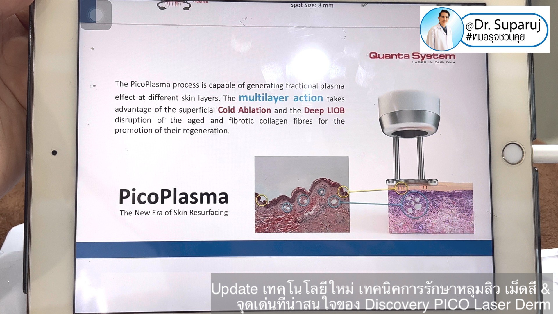 Update เทคโนโลยีใหม่ เทคนิคการรักษาหลุมสิว เม็ดสี & จุดเด่นที่น่าสนใจของ Discovery PICO Laser Derm Update เทคโนโลยีใหม่ เทคนิคการรักษาหลุมสิว เม็ดสี & จุดเด่นที่น่าสนใจของ Discovery PICO Laser Derm