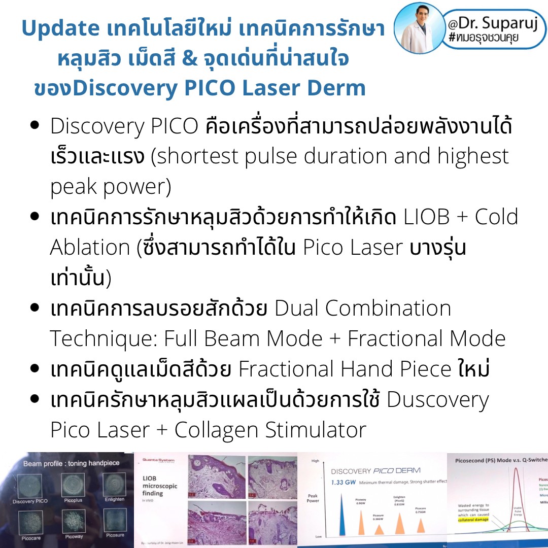 Update เทคโนโลยีใหม่ เทคนิคการรักษาหลุมสิว เม็ดสี & จุดเด่นที่น่าสนใจของ Discovery PICO Laser Derm Update เทคโนโลยีใหม่ เทคนิคการรักษาหลุมสิว เม็ดสี & จุดเด่นที่น่าสนใจของ Discovery PICO Laser Derm