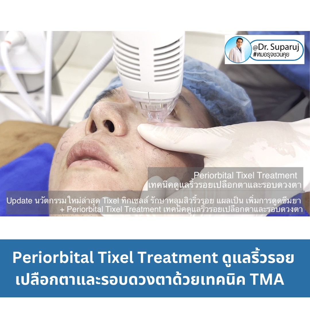 ผลลัพธ์อาจแตกต่างกันไป แล้วแต่บุคคล ผลลัพธ์อาจแตกต่างกันไป แล้วแต่บุคคล