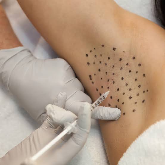 แนะนำเทคนิคดูแลโรคผิวหนัง: ภาวะเหงื่อออกมาก (Hyperhidrosis) คืออะไร & ดูแลได้อย่างไร? แนะนำเทคนิคดูแลโรคผิวหนัง: ภาวะเหงื่อออกมาก (Hyperhidrosis) คืออะไร & ดูแลได้อย่างไร?