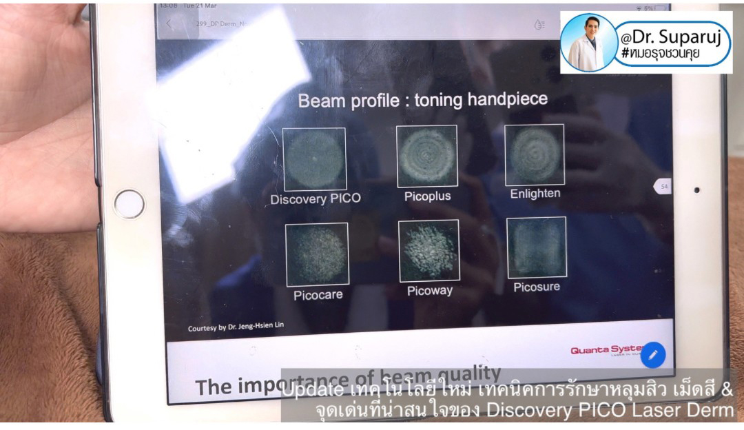 Update เทคโนโลยีใหม่ เทคนิคการรักษาหลุมสิว เม็ดสี & จุดเด่นที่น่าสนใจของ Discovery PICO Laser Derm Update เทคโนโลยีใหม่ เทคนิคการรักษาหลุมสิว เม็ดสี & จุดเด่นที่น่าสนใจของ Discovery PICO Laser Derm