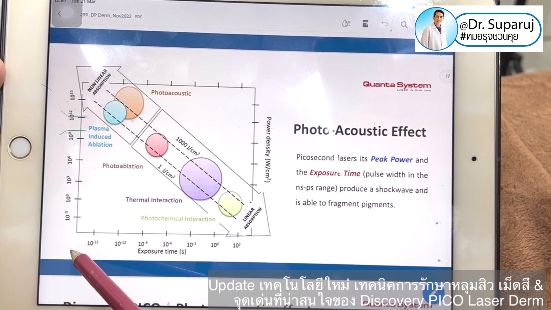 Update เทคโนโลยีใหม่ เทคนิคการรักษาหลุมสิว เม็ดสี & จุดเด่นที่น่าสนใจของ Discovery PICO Laser Derm Update เทคโนโลยีใหม่ เทคนิคการรักษาหลุมสิว เม็ดสี & จุดเด่นที่น่าสนใจของ Discovery PICO Laser Derm
