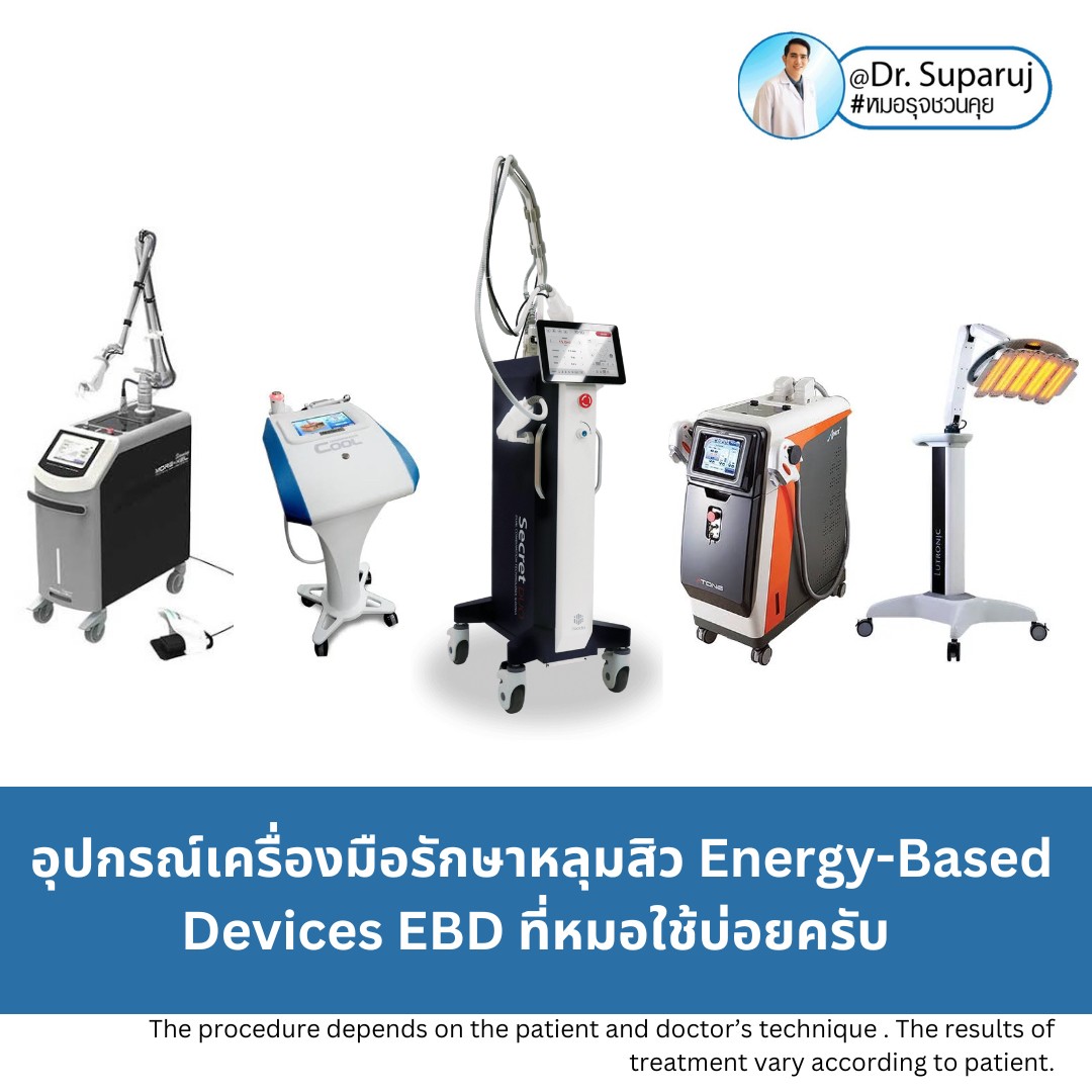 Update Energy-based Devices EBD อุปกรณ์เครื่องมือ ที่มีให้การดูแลรักษา ปัญหาผิว หลุมสิว ผมร่วงผมบาง แผลเป็น ขนคุดครับ (Update November 2023)