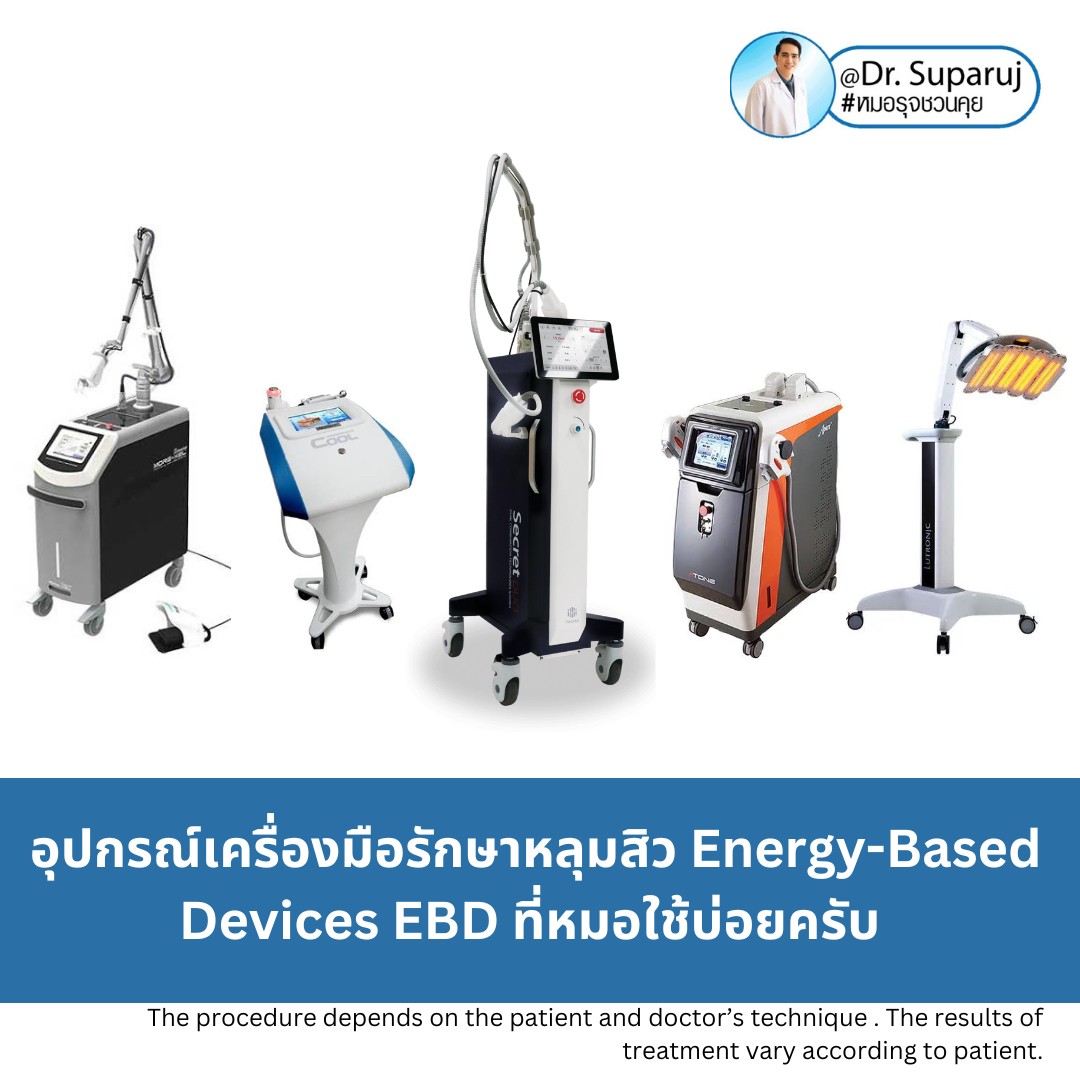 Update Energy-based Devices EBD อุปกรณ์เครื่องมือ ที่มีให้การดูแลรักษา ปัญหาผิว หลุมสิว ผมร่วงผมบาง แผลเป็น ขนคุดครับ (Update November 2023) Update Energy-based Devices EBD อุปกรณ์เครื่องมือ ที่มีให้การดูแลรักษา ปัญหาผิว หลุมสิว ผมร่วงผมบาง แผลเป็น ขนคุดครับ (Update November 2023)