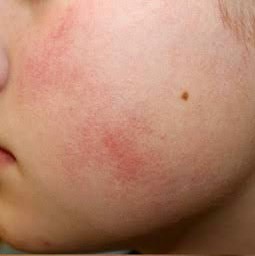 ขนคุดที่มีสีแดง KP Rubra มีลักษณะอย่างไร & ดูแลได้อย่างไร? ขนคุดที่มีสีแดง KP Rubra มีลักษณะอย่างไร & ดูแลได้อย่างไร?