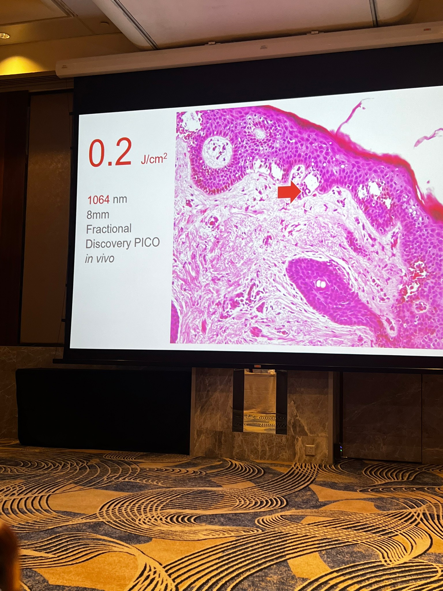 หมอรุจ ได้รับเชิญเข้าร่วมงานประชุม Quanta System Asia Pacific Expert Meeting 2024 ผู้เชี่ยวชาญด้านการใช้เลเซอร์ Discovery Pico Laser ที่ประเทศสิงคโปร์ หมอรุจ ได้รับเชิญเข้าร่วมงานประชุม Quanta System Asia Pacific Expert Meeting 2024 ผู้เชี่ยวชาญด้านการใช้เลเซอร์ Discovery Pico Laser ที่ประเทศสิงคโปร์