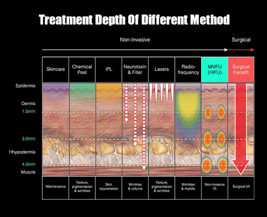 Recap เทคนิคยกกระชับผิว Skin Tightening 2025-2026 Recap เทคนิคยกกระชับผิว Skin Tightening 2025-2026