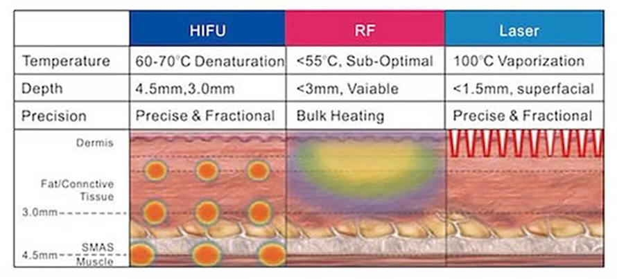Recap เทคนิคยกกระชับผิว Skin Tightening 2025-2026 Recap เทคนิคยกกระชับผิว Skin Tightening 2025-2026